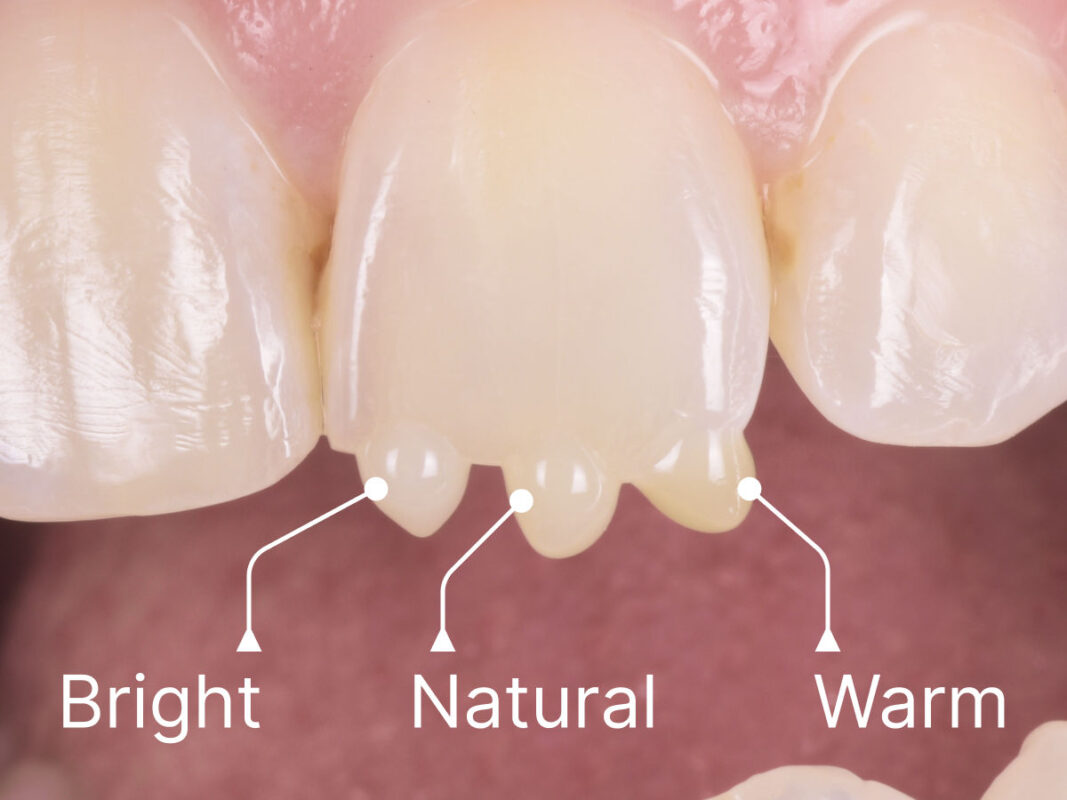 Solventum™-Filtek™-Easy-Match-Flowable-Restorative